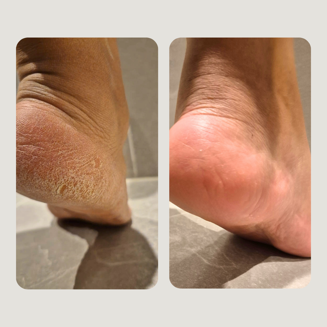 GlowStep <br> Fötter som strålar av lyx och komfort!